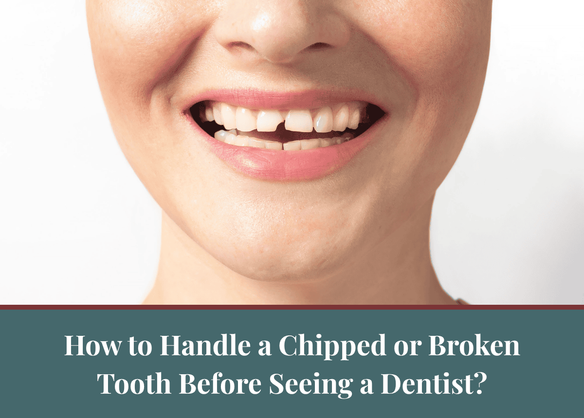 How to Handle a Chipped or Broken Tooth Before Seeing a Dentist