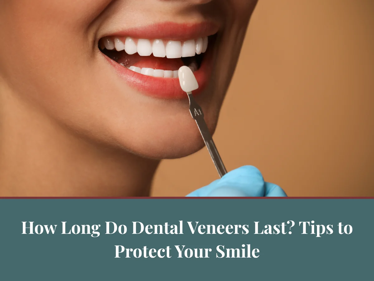How Long Do Dental Veneers Last? Tips to Protect Your Smile