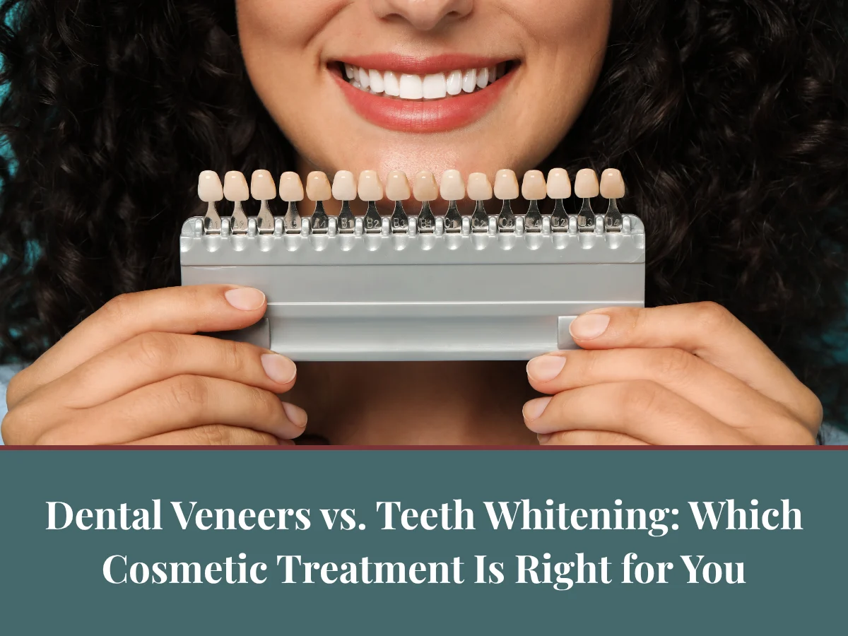 Dental Veneers vs. Teeth Whitening: Which Cosmetic Treatment Is Right for You?